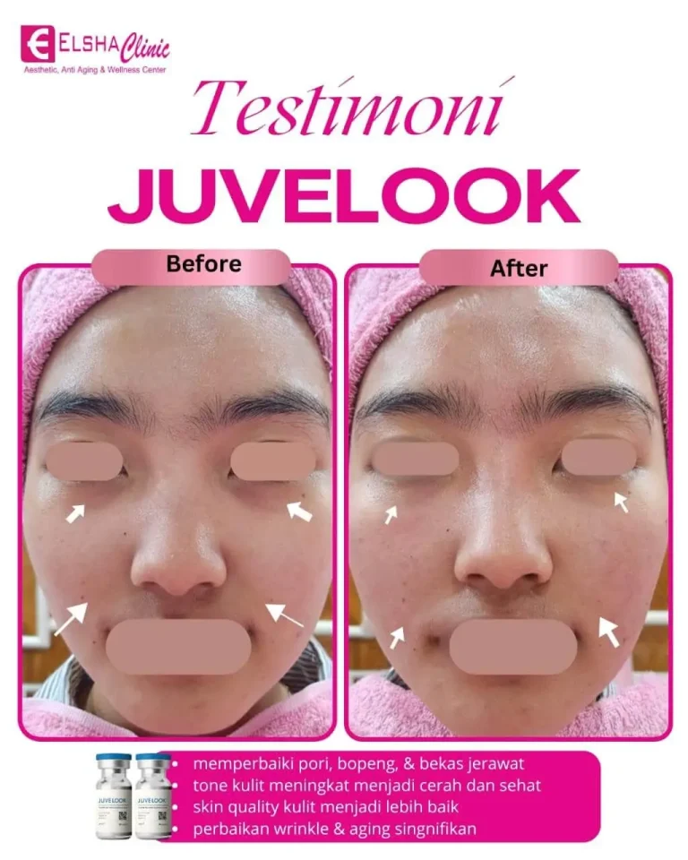 testimoni treatment3