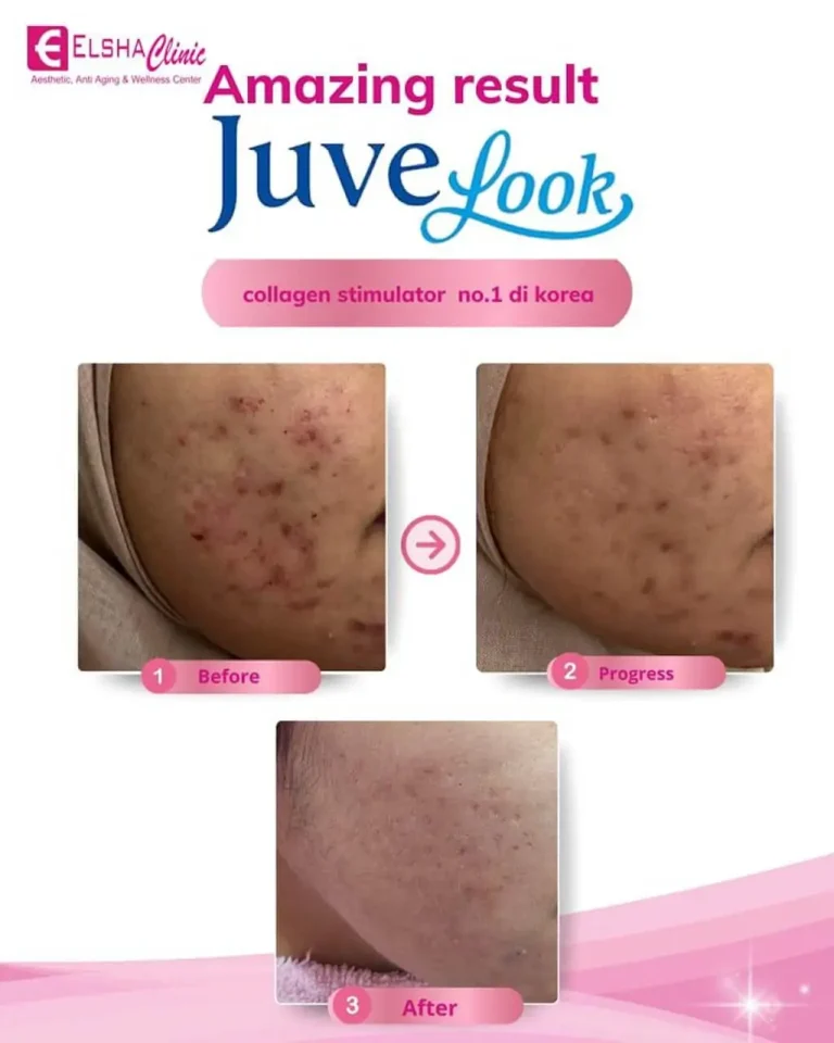 testimoni treatment4