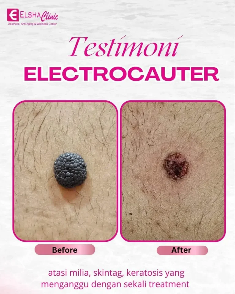 testimoni treatment5