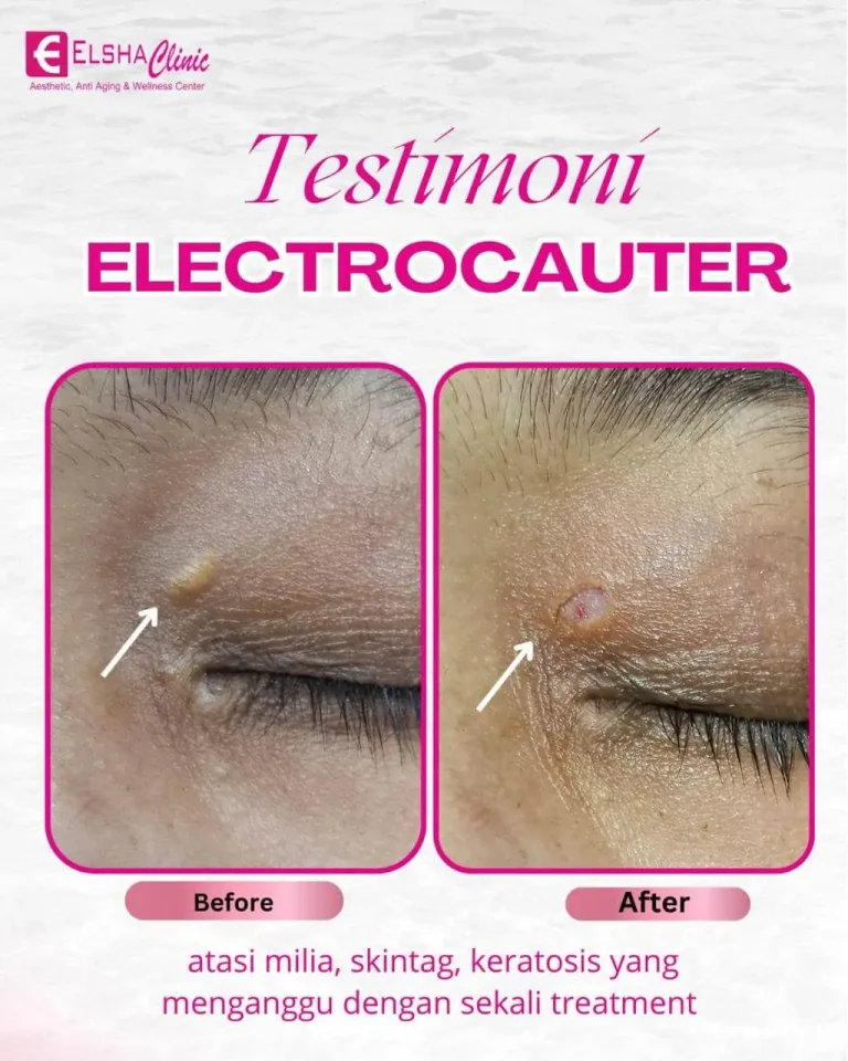 testimoni treatment6