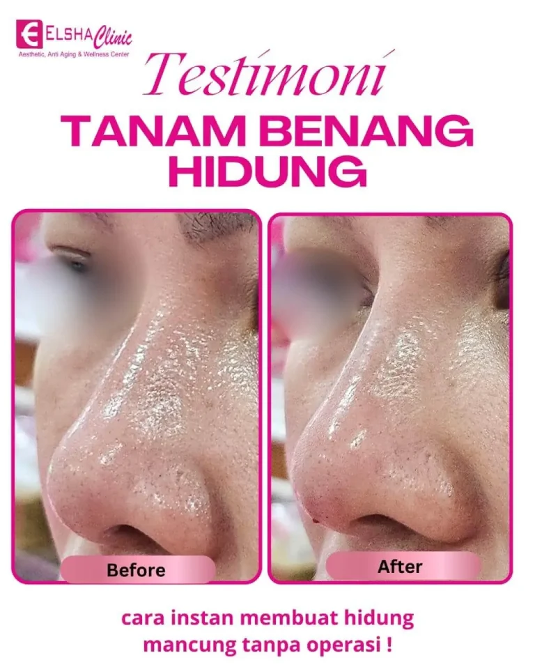 testimoni treatment8