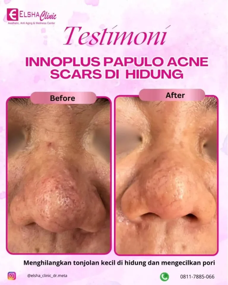testimoni treatment9